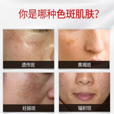 御雪价格表（御雪美白祛斑霜的官方网站）