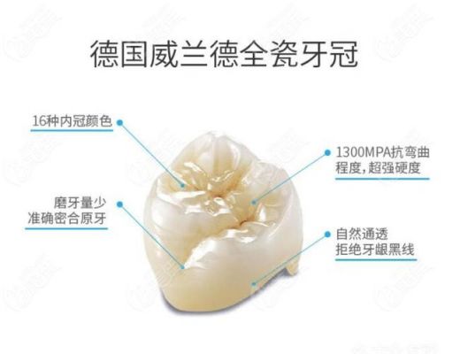 德国威兰德臻瓷价格表(威兰德臻瓷中文网)-图2 德国威兰德臻瓷价格表(威兰德臻瓷中文网)-图2