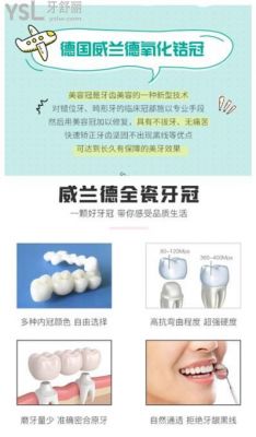 德国威兰德臻瓷价格表(威兰德臻瓷中文网)-图3 德国威兰德臻瓷价格表(威兰德臻瓷中文网)-图3