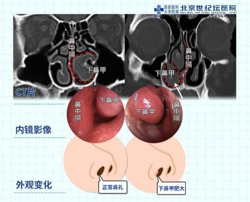 鼻悦宝价格（鼻宝灵价格）-图2