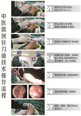 针刀镜价格(针刀镜的作用)-图1 针刀镜价格(针刀镜的作用)-图1