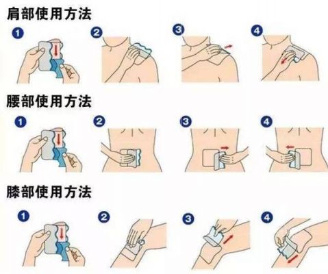 安颈贴价格(一整支安瓶的肩颈贴如何使用)-图2 安颈贴价格(一整支安瓶的肩颈贴如何使用)-图2