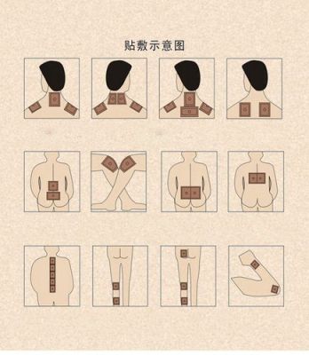 安颈贴价格(一整支安瓶的肩颈贴如何使用)-图3 安颈贴价格(一整支安瓶的肩颈贴如何使用)-图3