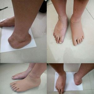 半足假肢价格(半足假肢价格多少钱)-图1 半足假肢价格(半足假肢价格多少钱)-图1