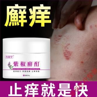 癣毒净价格(癣毒清多少钱一盒)-图3 癣毒净价格(癣毒清多少钱一盒)-图3