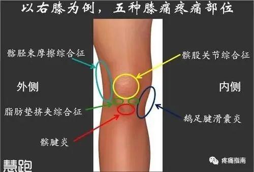 滑囊炎价格(滑囊炎能完全治好吗 新闻)-图1 滑囊炎价格(滑囊炎能完全治好吗 新闻)-图1