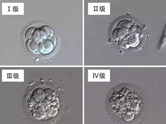 胚优的价格(胚优主要功效)-图3 胚优的价格(胚优主要功效)-图3
