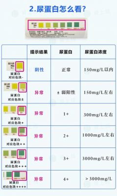 尿检的价格(尿检贵吗)-图2 尿检的价格(尿检贵吗)-图2