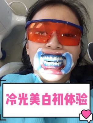 冷光白牙价格（冷光美白牙齿的价格是多少钱啊）