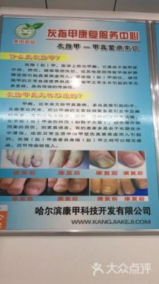 康甲价格(康甲120治疗灰指甲怎么样)-图1 康甲价格(康甲120治疗灰指甲怎么样)-图1
