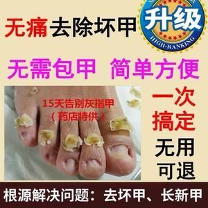 康甲价格(康甲120治疗灰指甲怎么样)-图3 康甲价格(康甲120治疗灰指甲怎么样)-图3