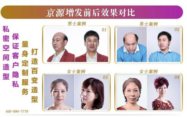 京源补发价格(京源补发怎么样)-图3 京源补发价格(京源补发怎么样)-图3