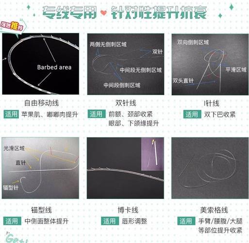 快翎线价格(快翎线是哪个国家的)-图3 快翎线价格(快翎线是哪个国家的)-图3