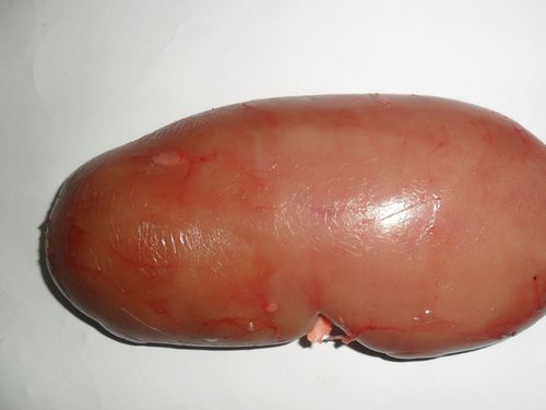 树腰子价格(树腰子怎么用)-图3 树腰子价格(树腰子怎么用)-图3