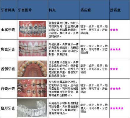 金属牙套价格（金属牙套价格表2022）