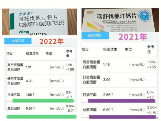 立妥普价格(立普妥的价格)-图2 立妥普价格(立普妥的价格)-图2