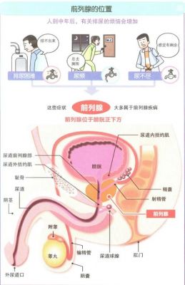 前列先锋价格（前列集团）