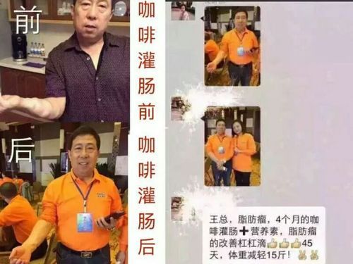 葛森疗法价格(葛森疗法有成功例子吗)-图3 葛森疗法价格(葛森疗法有成功例子吗)-图3