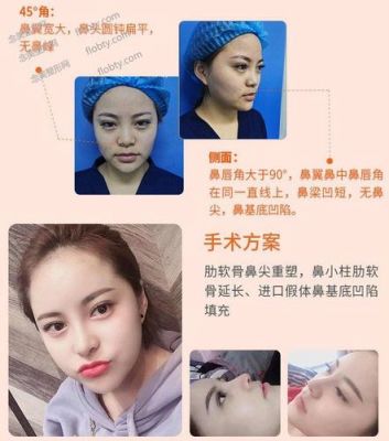 倪云志价格(倪云志鼻子怎么样)-图2 倪云志价格(倪云志鼻子怎么样)-图2