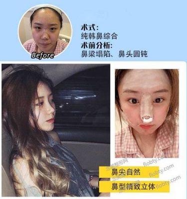倪云志价格(倪云志鼻子怎么样)-图3 倪云志价格(倪云志鼻子怎么样)-图3