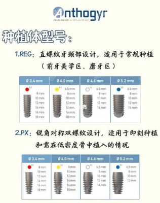 安卓健种植体价格(安卓健植体的优势)-图1 安卓健种植体价格(安卓健植体的优势)-图1