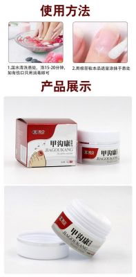 甲沟康价格(甲沟康保健膏的效果)-图2 甲沟康价格(甲沟康保健膏的效果)-图2