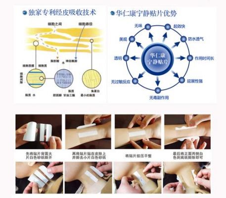 宁静贴片价格（宁静贴片贴在什么位置）