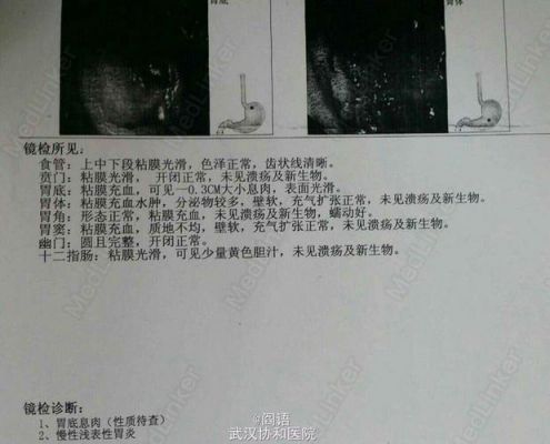 洛安命氨基酸价格（洛安命氨基酸250ml价格）