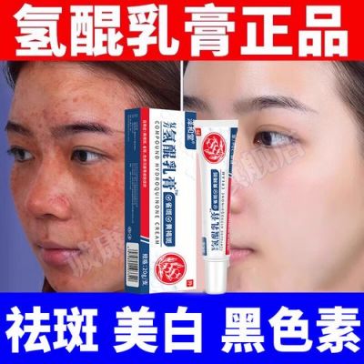 复方氢醌霜价格（复方氢醌霜图片与价格）