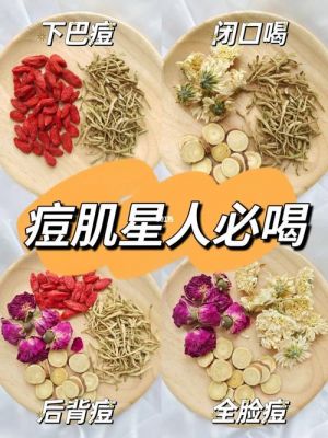 痘毒清价格（痘毒5号是治什么病）-图2