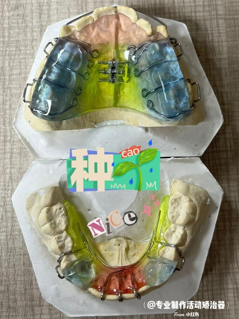 颌板的价格(颌板治疗是什么意思)-图3 颌板的价格(颌板治疗是什么意思)-图3