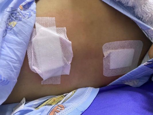 腰穿价格(腰穿价格差不多多少)-图2 腰穿价格(腰穿价格差不多多少)-图2