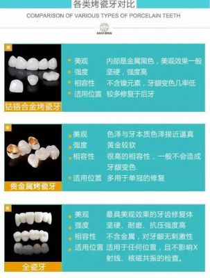 美容冠的价格(美容冠吧 百度贴吧)-图3 美容冠的价格(美容冠吧 百度贴吧)-图3