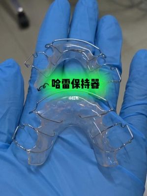 哈雷保持器价格(哈雷保持器价格一般是多少)-图2 哈雷保持器价格(哈雷保持器价格一般是多少)-图2