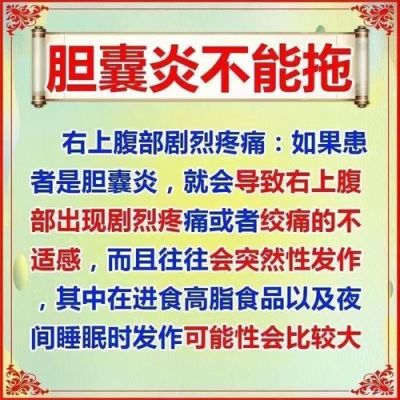 利胆醇价格(利胆醇胶囊哪里有卖)-图3 利胆醇价格(利胆醇胶囊哪里有卖)-图3