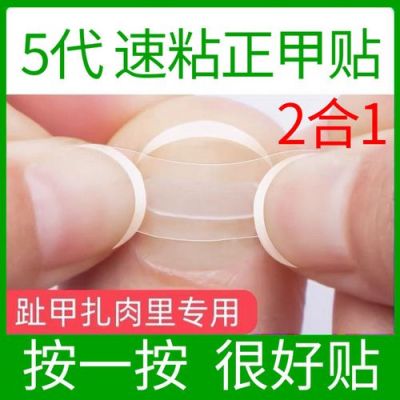 甲正贴价格(正甲贴是什么)-图3 甲正贴价格(正甲贴是什么)-图3