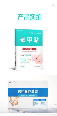 甲正贴价格（正甲贴是什么）